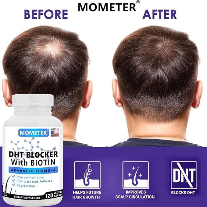 DHT Blocker Supplement for Hair Growth - Saw Palmetto, Biotin & Zinc for Women & Men - Stimulate Follicles, Reduce Hair Loss, Regrow Thicker Hair(120 Capsules)