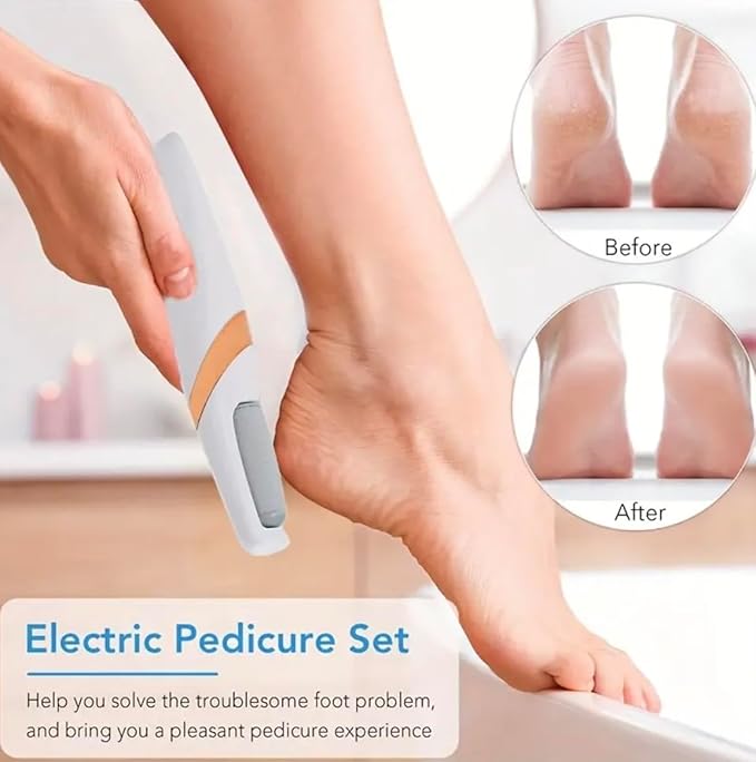 Electric Callus Remover for Feet, Professional Pedicure Tool and Foot File with 2 Roller Heads for Hard Skin, Removes Dry Dead Skin for Smoother Feet, Electric Foot Callus Remover for Foot Care