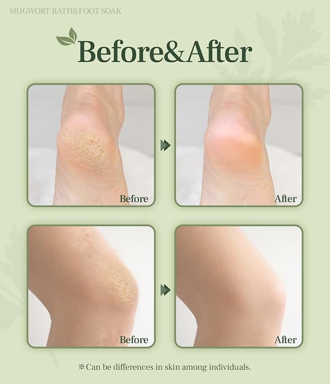 Monage Korean Organic Mugwort Bath and Foot Soak (10 Pack) Natural Home Spa Therapy with Traditional Korean Healing Properties and Relaxation Benefits, Skin Soothing, Muscle Relief, Korean Skin Care
