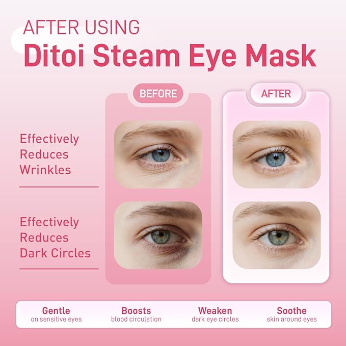 Eye Mask, Rich Hyaluronic Acid Heated Eye Masks for Sleep,Disposable SPA Warm Eye Compress for Dry Eyes,Dark Circles,Puffiness,Self Care,Travel Essentials 20 Packs (Rose)