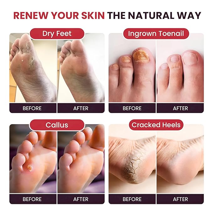 Foot Soak with Epsom Salts – All-Natural Blend for Relaxing Foot Care – Softens Calluses & Refreshes Feet – Invigorating Scent, Spa Pedicure, Made in USA – 16oz (Pack of 1)