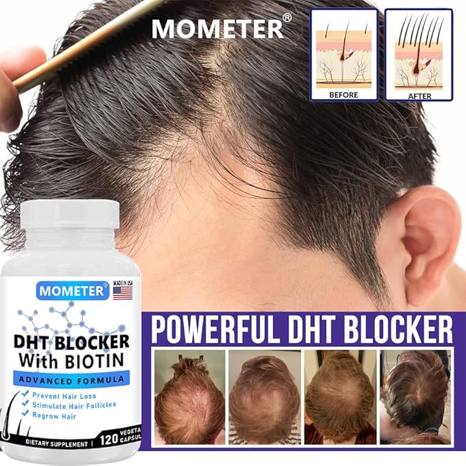 DHT Blocker Supplement for Hair Growth - Saw Palmetto, Biotin & Zinc for Women & Men - Stimulate Follicles, Reduce Hair Loss, Regrow Thicker Hair(120 Capsules)