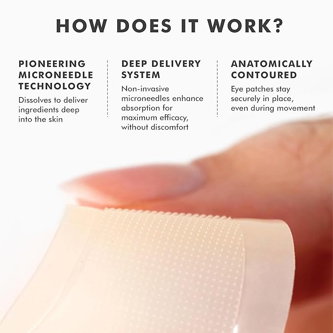 Skyn ICELAND Dissolving Microneedle Under Eye Patches with 39% Hyaluronic Acid and Peptides, No Slip Overnight Eye Mask for Fine Lines, Wrinkles and Firming, Vegan, All Skin Types, 1 Pair