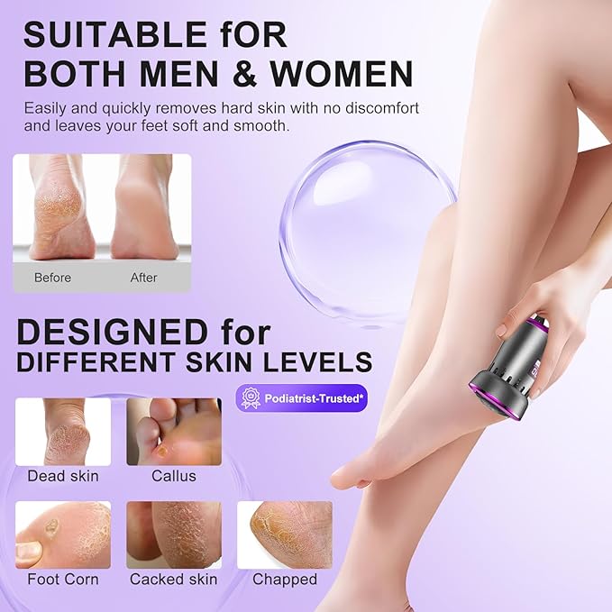 2025 Electric Foot Callus Remover, Rechargeable Pedicure Tool, Stainless Steel Heads for Dry Heels (Gray Purple)