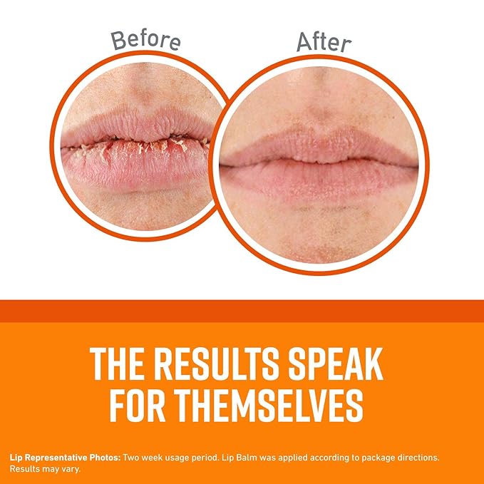 O'Keeffe's Lip Repair Unscented Lip Balm for Dry, Cracked Lips - Stick (3 Pack) - Moisturizer for Very Dry Lips